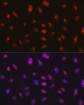 Anti- RB antibody produced in rabbit