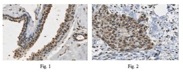 Anti-PALB2 Antibody from rabbit, purified by affinity chromatography