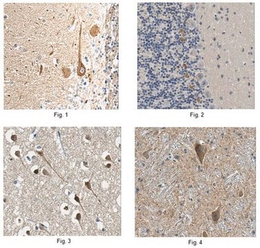 Anti-Potassium Channel Kv&#946;2 Antibody clone K17/70, from mouse