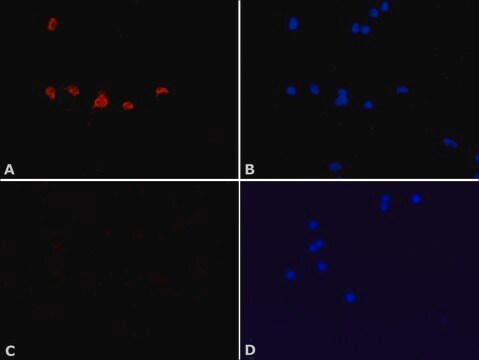 Anti-p8/TTD-A (C-terminal) antibody produced in rabbit ~1&#160;mg/mL, affinity isolated antibody, buffered aqueous solution