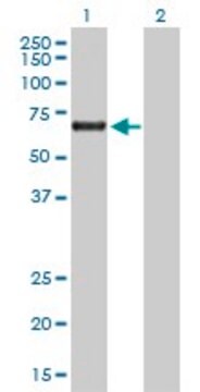 抗ACD抗体 ウサギ宿主抗体 purified immunoglobulin, buffered aqueous solution