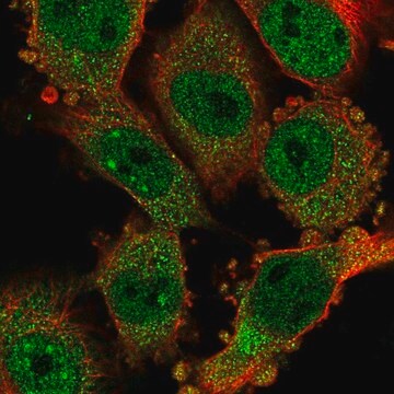 Anti-CCDC159 antibody produced in rabbit Prestige Antibodies&#174; Powered by Atlas Antibodies, affinity isolated antibody