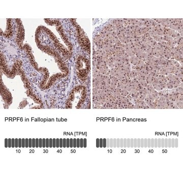 Anti-PRPF6 antibody produced in rabbit Prestige Antibodies&#174; Powered by Atlas Antibodies, affinity isolated antibody, buffered aqueous glycerol solution