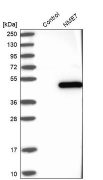 Anti-NME7 antibody produced in rabbit Prestige Antibodies&#174; Powered by Atlas Antibodies, affinity isolated antibody, buffered aqueous glycerol solution