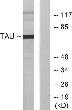 Anti-TAU antibody produced in rabbit affinity isolated antibody