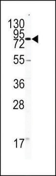 ANTI-CD31(C-TERMINAL) antibody produced in rabbit purified immunoglobulin, buffered aqueous solution