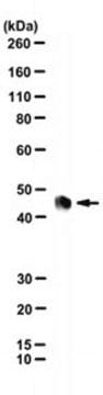 Anti-Rabies Virus Phosphoprotein Antibody, clone M974