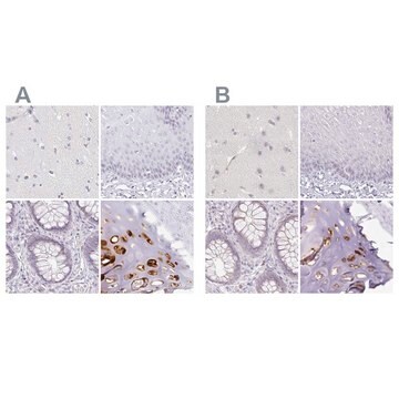 Anti-ACAN antibody produced in rabbit Prestige Antibodies&#174; Powered by Atlas Antibodies, affinity isolated antibody