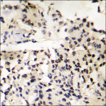 Anti-phospho-MDM4 (pSer367) antibody produced in rabbit affinity isolated antibody