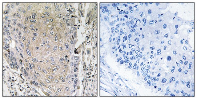 Anti-CBLN3, antibody produced in rabbit affinity isolated antibody