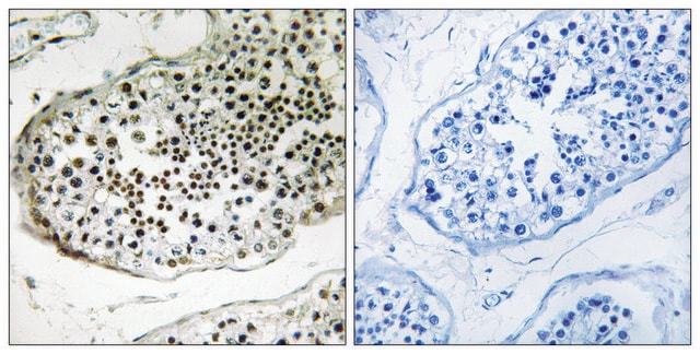 Anti-UBQLN3 antibody produced in rabbit affinity isolated antibody