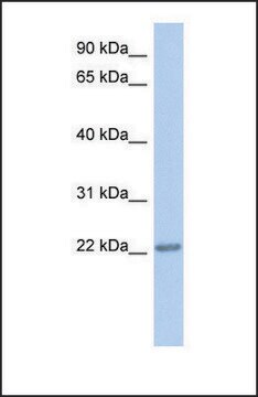 Anti-TRAPPC5 antibody produced in rabbit affinity isolated antibody