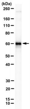 Anti-EBNA1 Antibody, clone 1H4