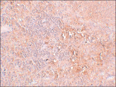 Anti-JMJD4 antibody produced in rabbit affinity isolated antibody, buffered aqueous solution