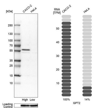 Anti-GPT2 antibody produced in rabbit Prestige Antibodies&#174; Powered by Atlas Antibodies, affinity isolated antibody, buffered aqueous glycerol solution