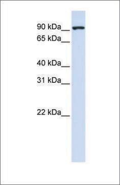 Anti-CTAGE5 (ab1) antibody produced in rabbit affinity isolated antibody