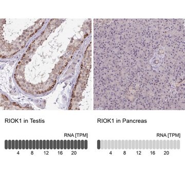 Anti-RIOK1 antibody produced in rabbit Prestige Antibodies&#174; Powered by Atlas Antibodies, affinity isolated antibody, buffered aqueous glycerol solution