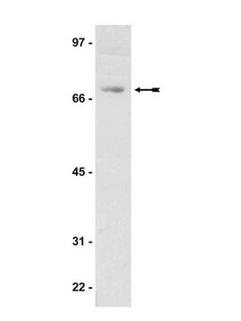 Anti-WAVE2/Scar2 Antibody serum, Upstate&#174;