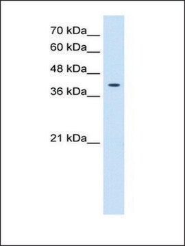 Anti-TSPAN12 antibody produced in rabbit affinity isolated antibody