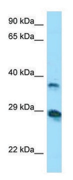 Anti-VSIG4 (N-terminal) antibody produced in rabbit affinity isolated antibody