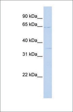 Anti-RORA (ab2) antibody produced in rabbit affinity isolated antibody