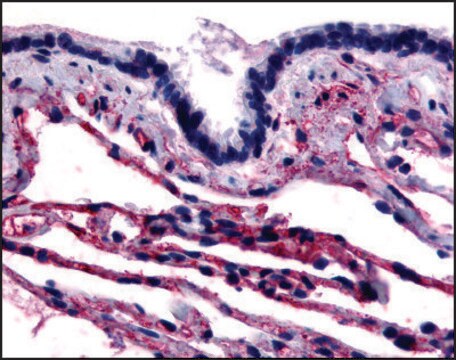 Anti-CAV1 (AB2) antibody produced in rabbit affinity isolated antibody, buffered aqueous solution