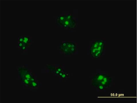 Anti-UTP14A antibody produced in mouse purified immunoglobulin, buffered aqueous solution