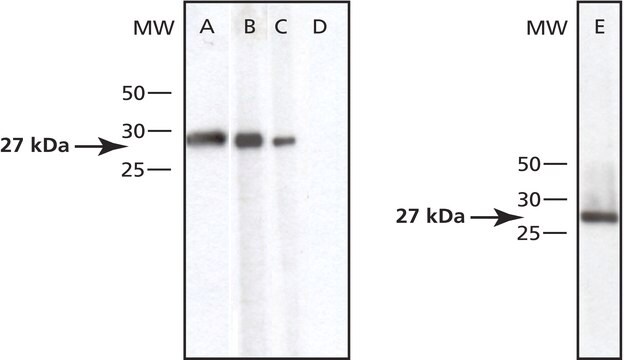 Anti-Ubiquitin C-terminal Hydrolase L1 (RA-15) antibody produced in rabbit IgG fraction of antiserum, buffered aqueous solution