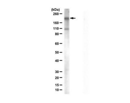 Anti-CEP164 from rabbit