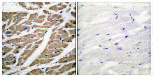 Anti-SODIUM CHANNEL-PAN antibody produced in rabbit affinity isolated antibody