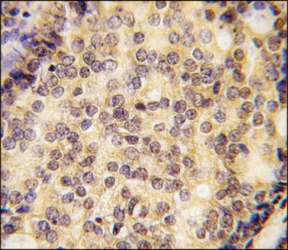 Anti-SHB (center) antibody produced in rabbit saturated ammonium sulfate (SAS) precipitated, buffered aqueous solution