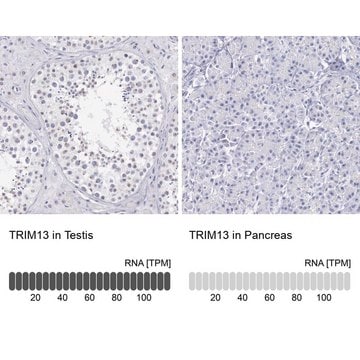 Anti-TRIM13 antibody produced in rabbit Prestige Antibodies&#174; Powered by Atlas Antibodies, affinity isolated antibody, buffered aqueous glycerol solution