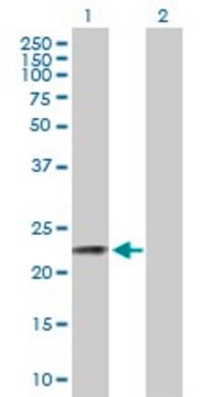 Anti-CSN3 antibody produced in mouse purified immunoglobulin, buffered aqueous solution