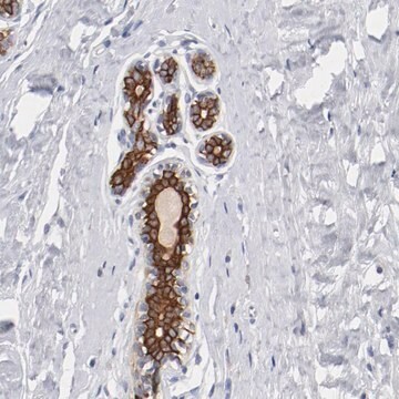 Anti-TSPAN6 antibody produced in rabbit Prestige Antibodies&#174; Powered by Atlas Antibodies, affinity isolated antibody, buffered aqueous glycerol solution