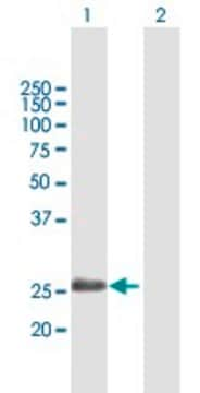 Anti-ADH6 antibody produced in mouse purified immunoglobulin, buffered aqueous solution