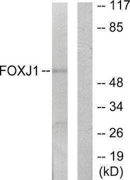 Anti-FOXJ1 antibody produced in rabbit affinity isolated antibody