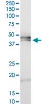 ANTI-HPR antibody produced in mouse purified immunoglobulin, buffered aqueous solution