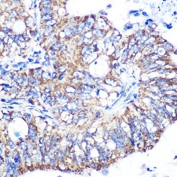 Anti-IDH2 antibody produced in rabbit