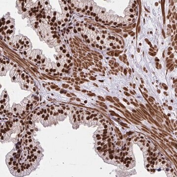 Anti-TBL1Y antibody produced in rabbit Prestige Antibodies&#174; Powered by Atlas Antibodies, affinity isolated antibody, buffered aqueous glycerol solution