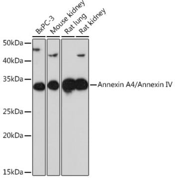 Anti-Annexin A4/Annexin IV Antibody, clone 8T6E6, Rabbit Monoclonal