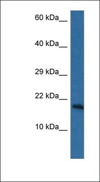 Anti-PNKD antibody produced in rabbit affinity isolated antibody