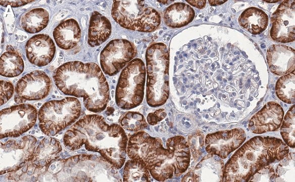 Anti-CD147 Antibody, clone 1J7 ZooMAb&#174; Rabbit Monoclonal recombinant, expressed in HEK 293 cells