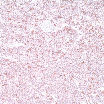 ZAP-70 (2F3.2) Mouse Monoclonal Antibody