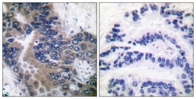 Anti-APAF-1-ALT antibody produced in rabbit affinity isolated antibody