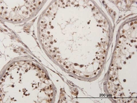 Monoclonal Anti-CHEK2 antibody produced in mouse clone 4F10, purified immunoglobulin, buffered aqueous solution