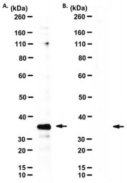 Anti-MGAT1 Antibody, clone 5F5