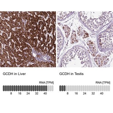 Anti-GCDH antibody produced in rabbit Prestige Antibodies&#174; Powered by Atlas Antibodies, affinity isolated antibody, buffered aqueous glycerol solution