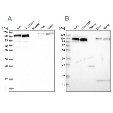 Anti-ERC1 antibody produced in rabbit Prestige Antibodies&#174; Powered by Atlas Antibodies, affinity isolated antibody, buffered aqueous glycerol solution, Ab3