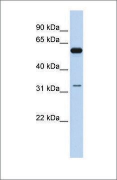 Anti-DDX28 antibody produced in rabbit affinity isolated antibody