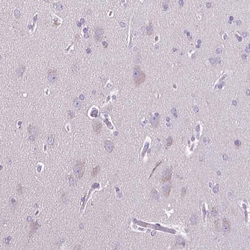 Anti-ACTRT3 antibody produced in rabbit Prestige Antibodies&#174; Powered by Atlas Antibodies, affinity isolated antibody, buffered aqueous glycerol solution